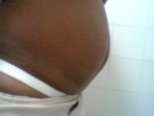uma lipocavitação